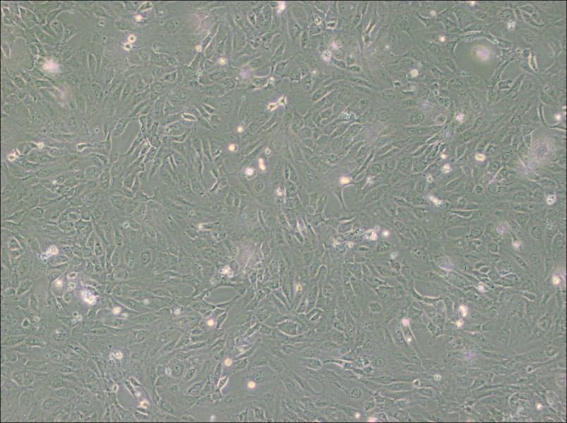 PUMC-HUVEC-T1 Cell Complete Medium - 2