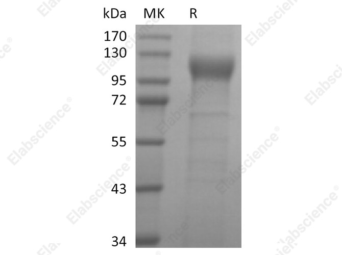 Recombinant Human ACE2 Protein (Avi-His Tag) - 1