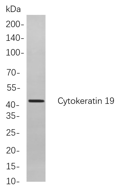 Recombinant Cytokeratin 19 Monoclonal Antibody-searchlist-1