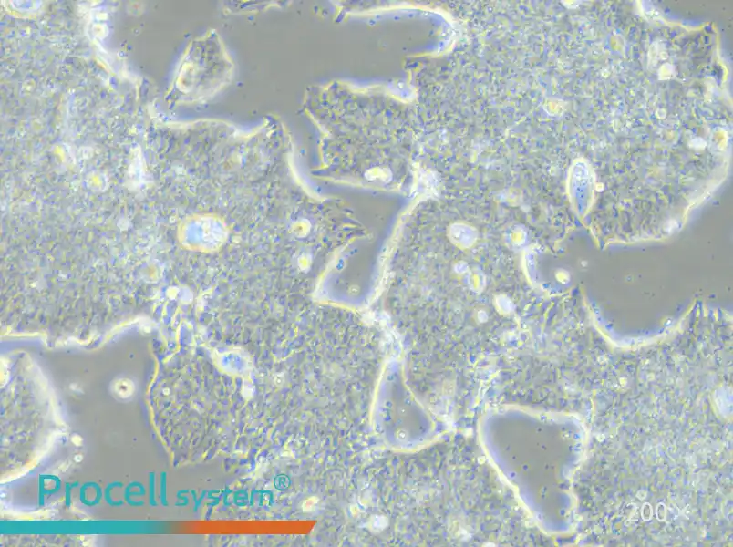 T84 Cell Complete Medium - small - 4