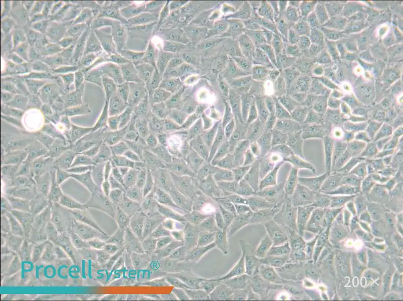 9L/lacZ Cell Complete Medium - small - 5