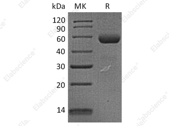 Recombinant Human Dectin-1/CLEC7A Protein (Fc Tag) - 1
