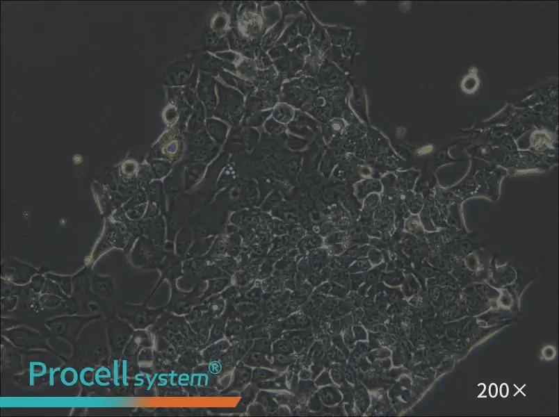 OE33 Cell Complete Medium - 4