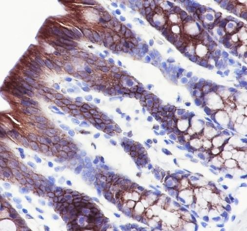 Recombinant SLC16A1 Monoclonal Antibody - 2