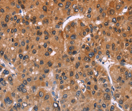 ING2 Polyclonal Antibody - 3