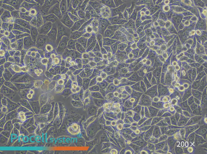 SK-BR-3 [SKBR3] Cell Complete Medium - small - 4