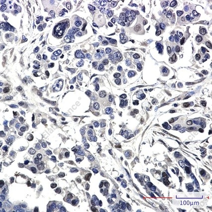 Recombinant Bag1 Monoclonal Antibody - 2