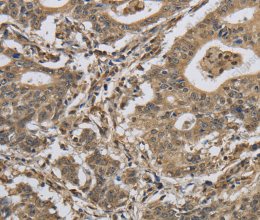IPO7 Polyclonal Antibody - 2