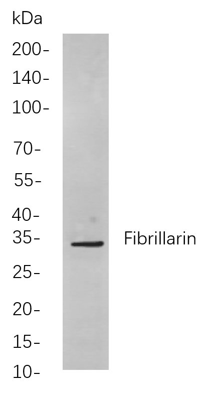 Recombinant Fibrillarin Monoclonal Antibody-searchlist-1