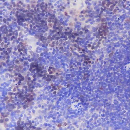 Recombinant Aurora B Monoclonal Antibody - 3