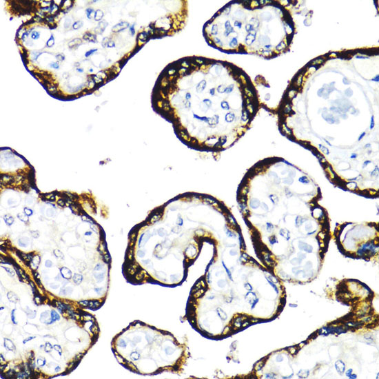 FGFR2 Polyclonal Antibody - small - 5