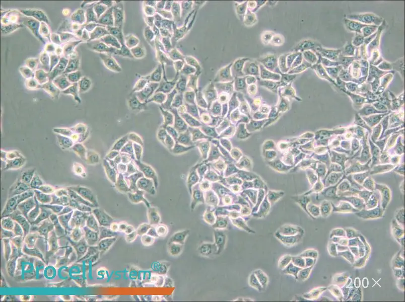 RT-112 Cell Complete Medium - small - 4