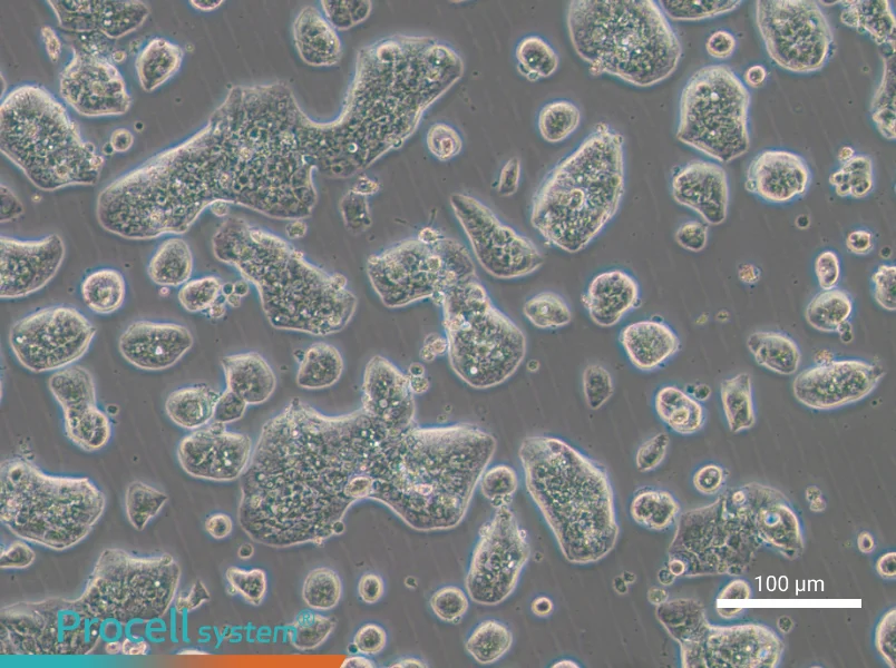 NCI-H1781NCI-H1781 - 2