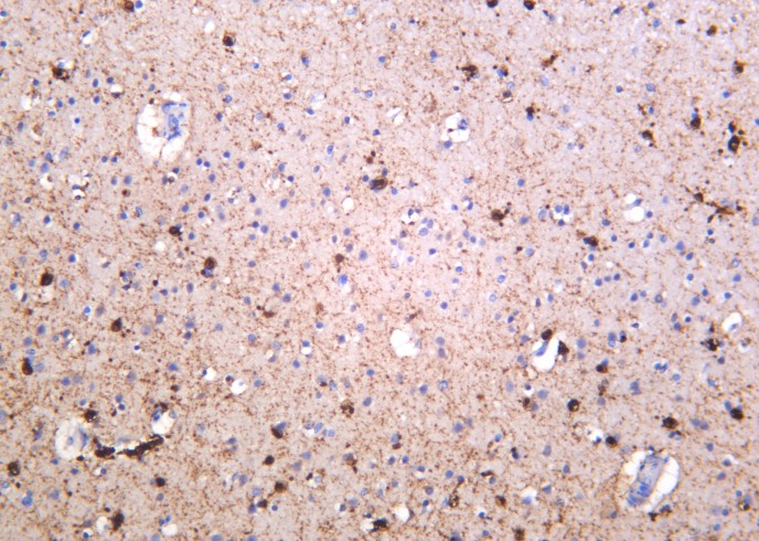 Recombinant NMDAR1 Monoclonal Antibody-searchlist-1
