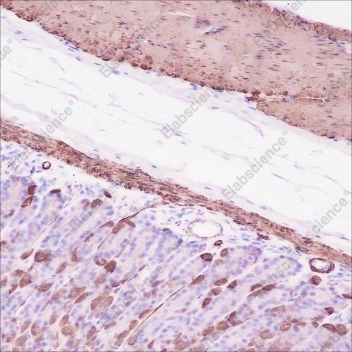 Recombinant alpha smooth muscle Actin Monoclonal Antibody - 5