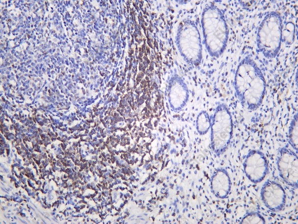 Recombinant CD2 Monoclonal Antibody - 1