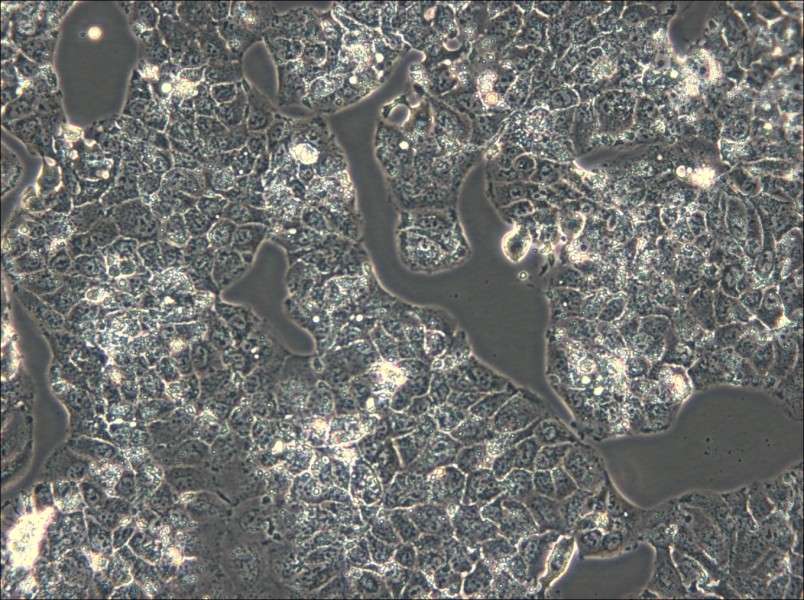 HuH-1 Cell Complete Medium - small - 6