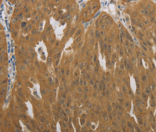NIT2 Polyclonal Antibody - 3