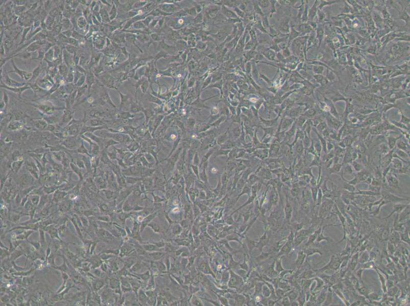 Tb 1 Lu Cell Complete Medium - 3