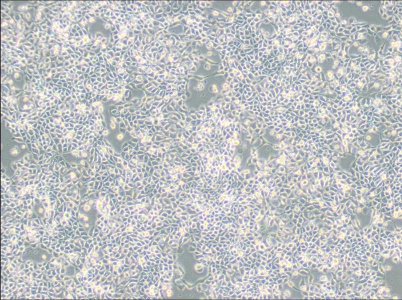 RT-112 Cell Complete Medium - 2