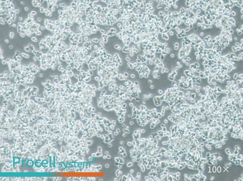 SK-NEP-1 Cell Complete Medium - 1