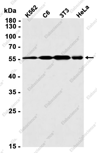 Recombinant DKC1 Monoclonal Antibody - 2