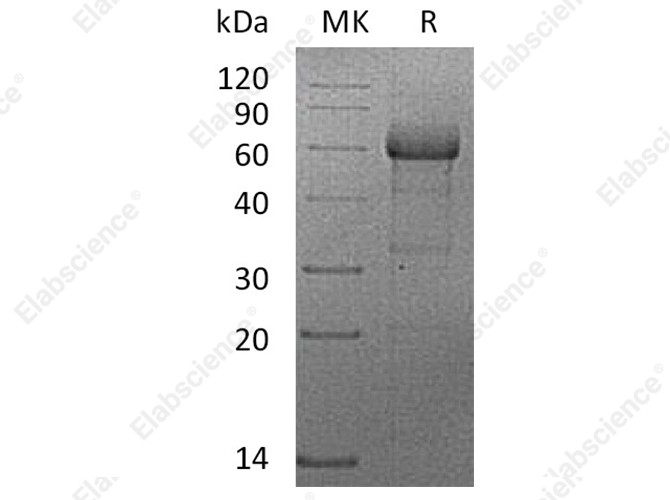 Recombinant Human TNFRSF1B/CD120b Protein (mFc Tag) - 1