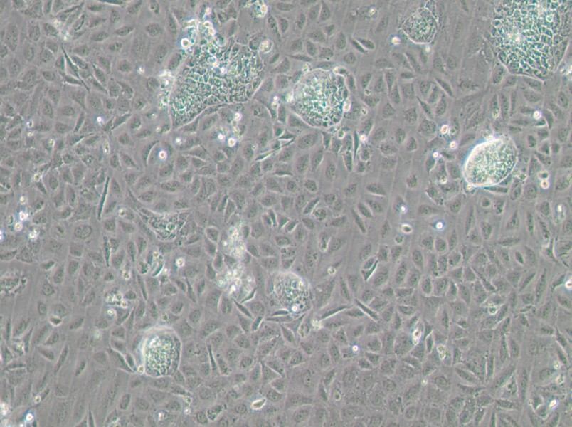TR-LCC-1 Cell Complete Medium - 2