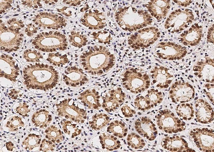 p38 alpha/MAPK14 Monoclonal Antibody - small - 3