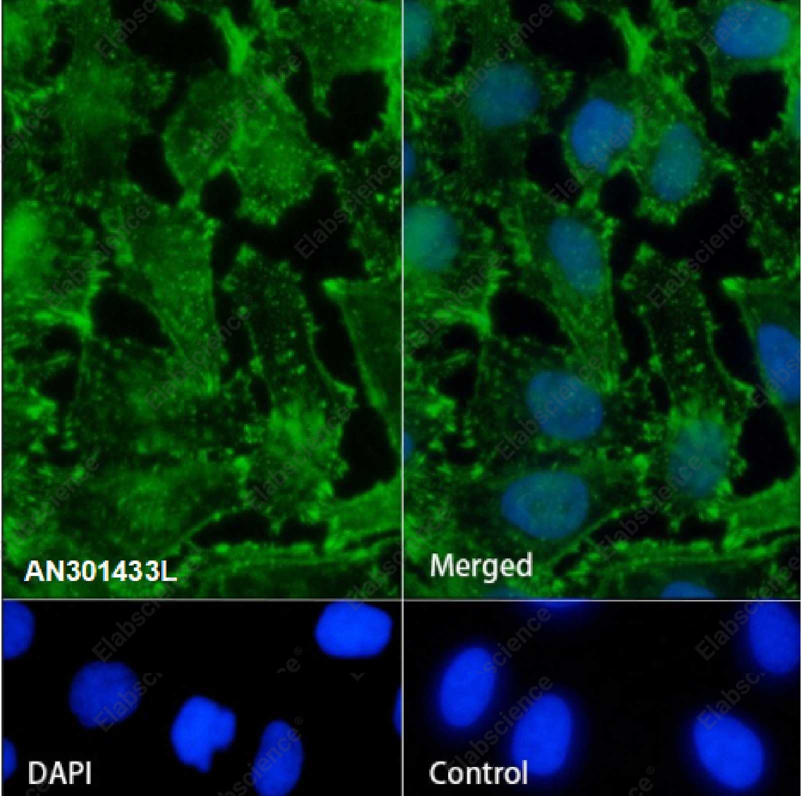 Recombinant alpha Actinin 4 Monoclonal Antibody - 3