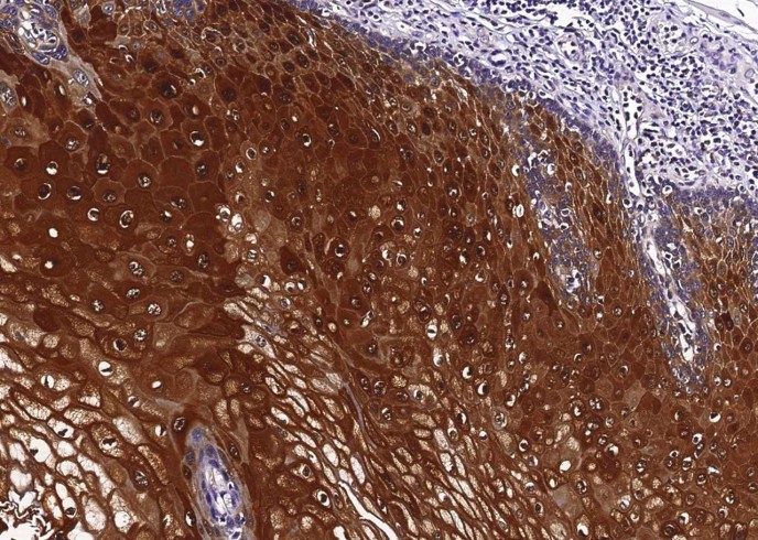 Recombinant SerpinB4/SCCA2 Monoclonal Antibody - small - 2