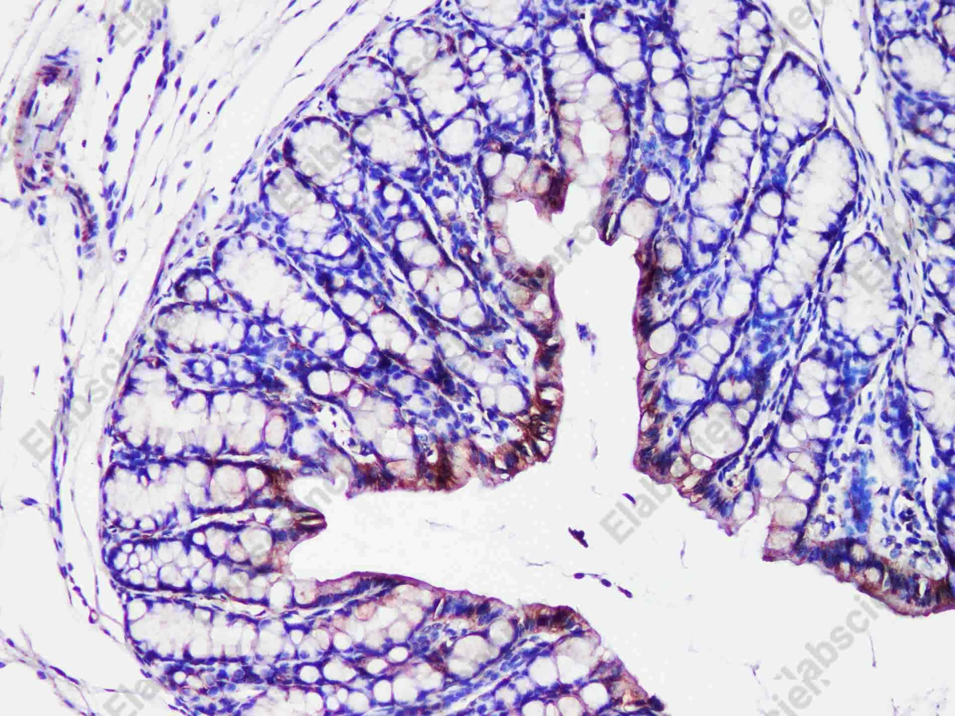ST14 Polyclonal Antibody - 3