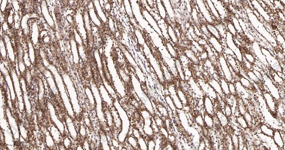 Recombinant SDHA Monoclonal Antibody - 3