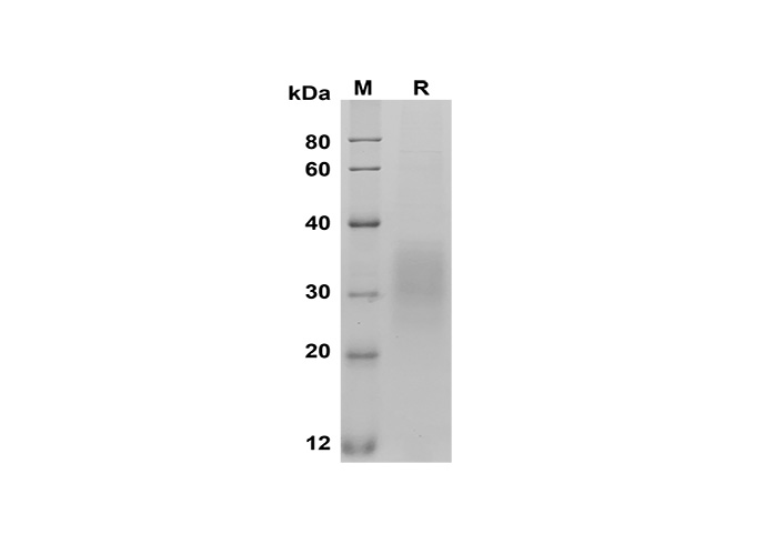 Recombinant Human IL-4 Protein-产品推荐-8