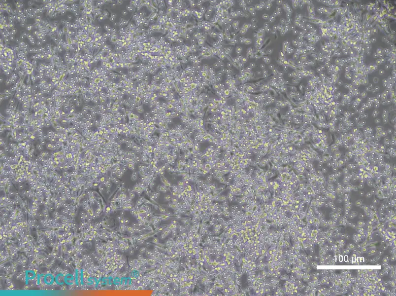 Human Peripheral Blood Immature Dendritic Cell Complete Medium - 3