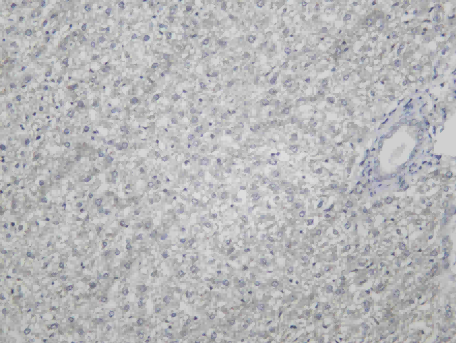 Recombinant NUMB Monoclonal Antibody - 1