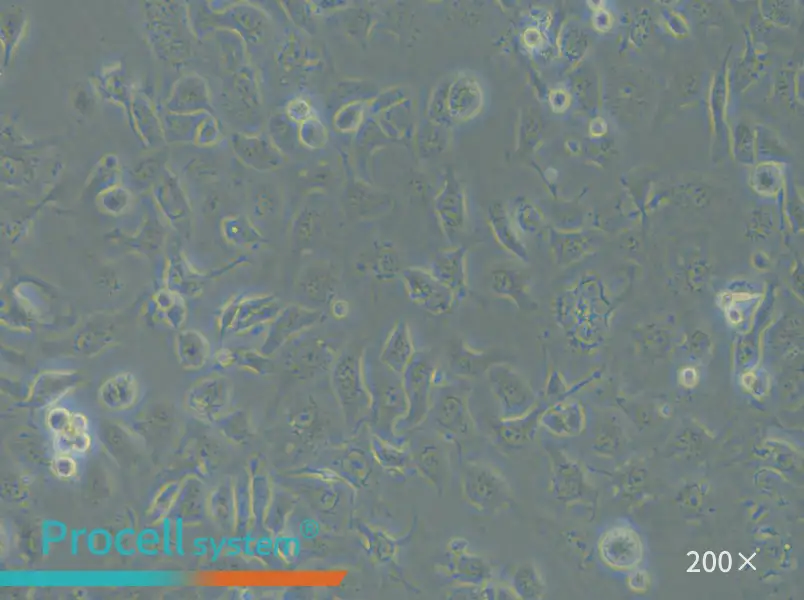 IGROV-1 Cell Complete Medium - 5