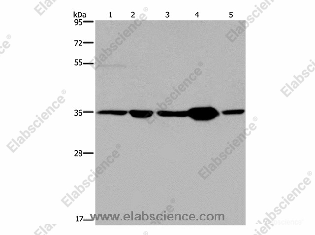 LZTFL1 Polyclonal Antibody - 1