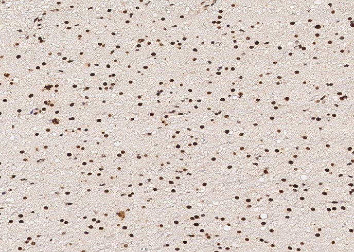 p38 alpha/MAPK14 Monoclonal Antibody-searchlist-1