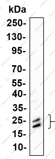 Recombinant Presenilin 1 Monoclonal Antibody - 5