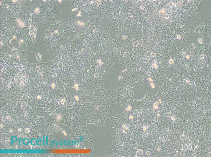 NCI-H2228 [H2228; H-2228] Cell Complete Medium - 3