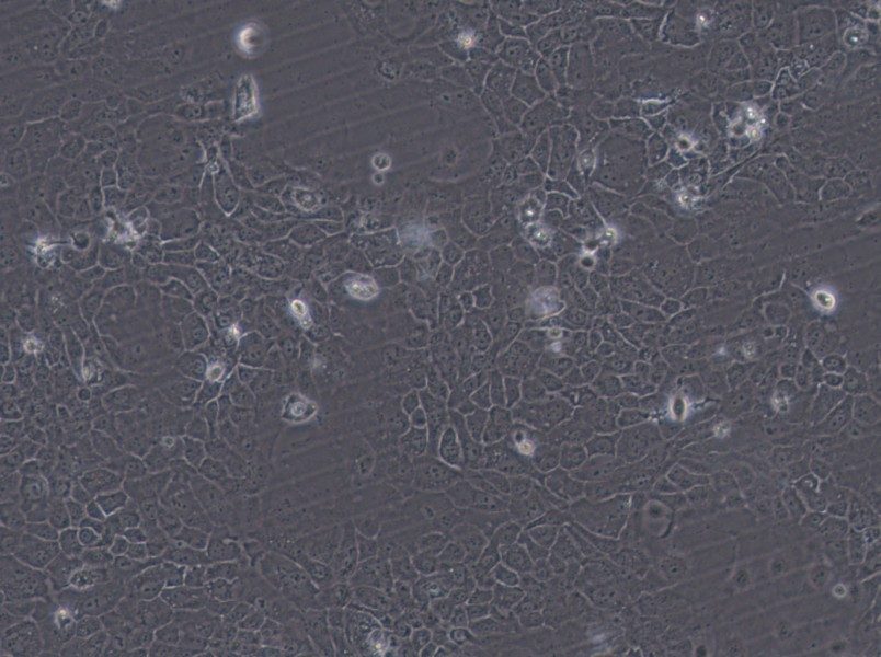 SCaBER Cell Complete Medium - 2