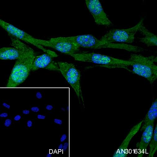 Recombinant PPP1CB Monoclonal Antibody - small - 4