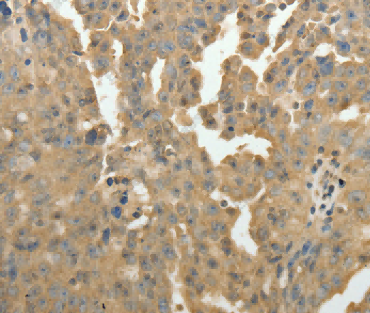 PSMD9 Polyclonal Antibody - 2