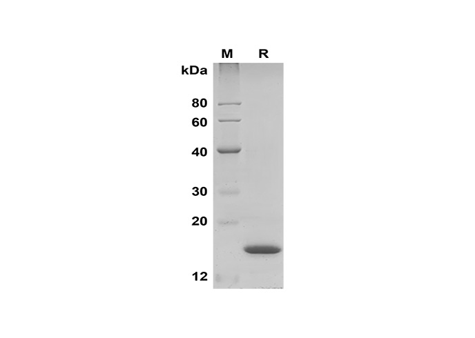 Recombinant Rat CD86 Protein(His Tag)-产品推荐-1