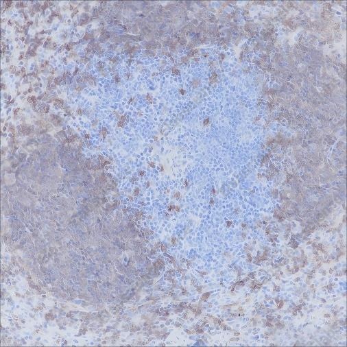 Recombinant CD20 Monoclonal Antibody - 3
