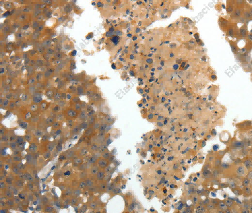 CRP Polyclonal Antibody - 2