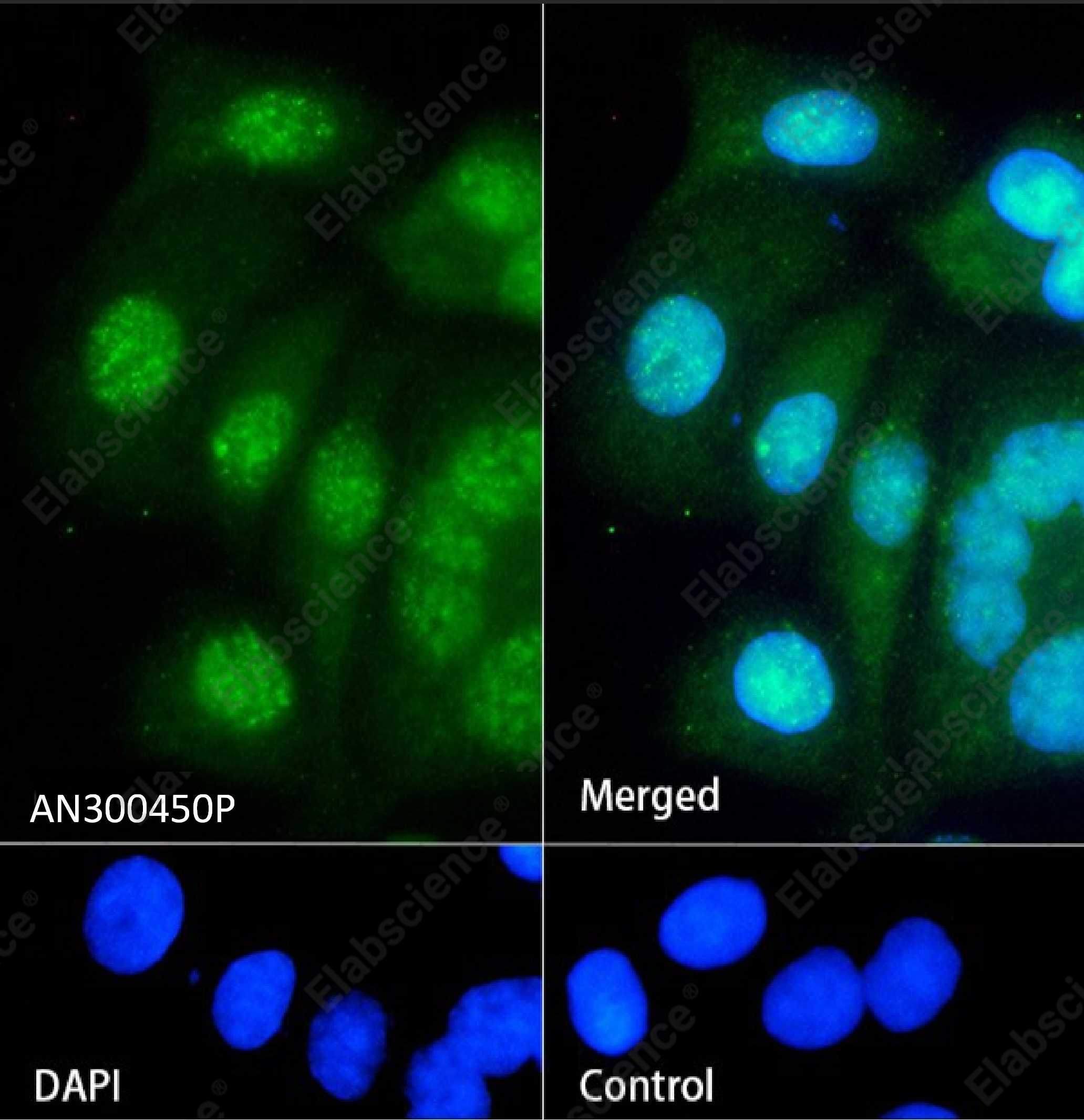 Recombinant ARL2BP/BART1 Monoclonal Antibody - 2