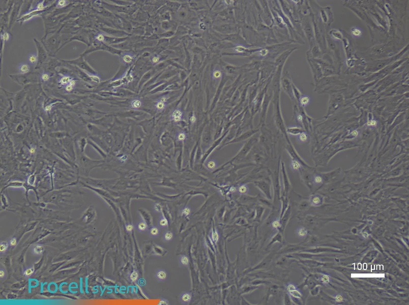 Rat Uterine Fibroblast Complete Medium - 1