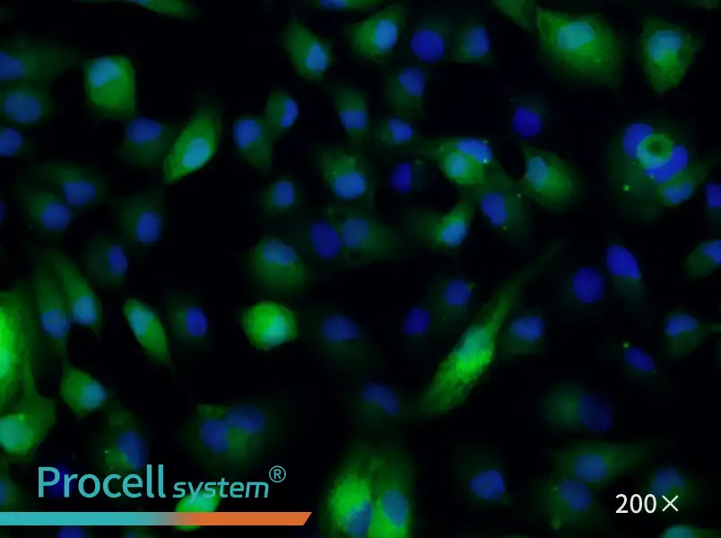 ACHN-GFP Cell Complete Medium - 4